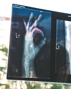 radiology hand
