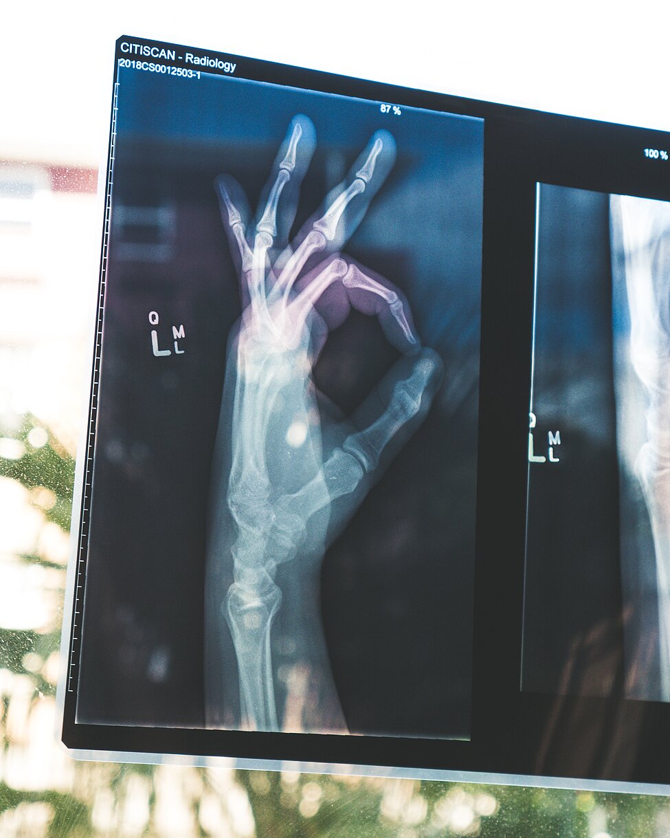 Credit: Owen Beard @ unsplash radiology hand
